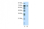 ARP39346_T100 - Kelch-like protein 26