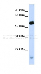 ARP39397_P050 - KCMF1