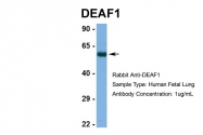 ARP39467_P050 - DEAF1