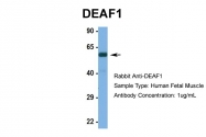 ARP39467_P050 - DEAF1