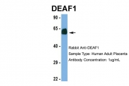ARP39467_P050 - DEAF1