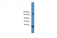 ARP39482_P050 - KDM6A / UTX