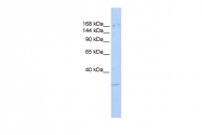 ARP39483_P050 - KDM6A / UTX