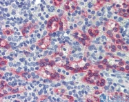 ARP39498_P050 - ZNF71