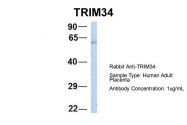 ARP39503_P050 - TRIM34 / RNF21