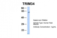 ARP39503_P050 - TRIM34 / RNF21