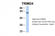 ARP39503_P050 - TRIM34 / RNF21