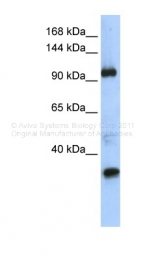 ARP39567_P050 - RBM21 / TUT1
