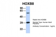 ARP39583_P050 - HOXB8 / HOX2D