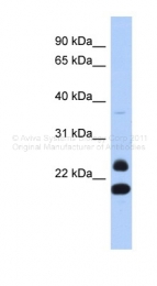 ARP39585_P050 - Neurogenin 2