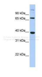 ARP39667_P050 - SOX7