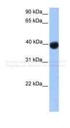 ARP39711_P050 - SSBP4