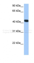 ARP39712_P050 - SSBP4