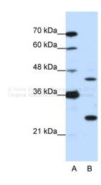 ARP39721_T100 - MYC-induced nuclear antigen