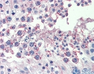 ARP39743_P050 - CPXCR1