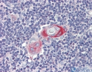 ARP39743_P050 - CPXCR1