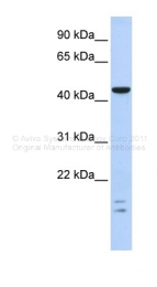 ARP39757_P050 - BTBD6 / BDPL