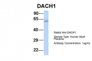 ARP39787_P050 - DACH1