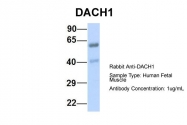 ARP39787_P050 - DACH1