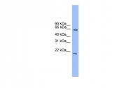 ARP39788_P050 - DACH1