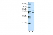 ARP39834_P050 - ZNF558