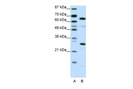 ARP39852_P050 - HMGB4