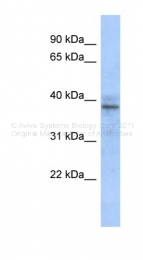 ARP39853_P050 - ZNF625