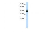 ARP39863_T100 - GS homeobox 2 / GSH2