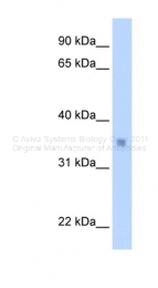 ARP39967_P050 - Max-like protein X