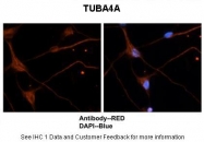 ARP40179_P050 - alpha Tubulin / TUBA4A / TUBA1