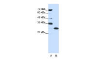 ARP40203_P050 - ANP32A