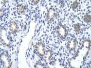 ARP40205_T100 - Cytokeratin 18