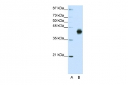 ARP40206_T100 - Cytokeratin 18