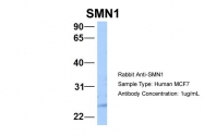 ARP40209_P050 - SMN1 / SMN2