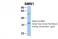 ARP40209_P050 - SMN1 / SMN2