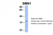 ARP40209_P050 - SMN1 / SMN2