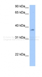 ARP40257_P050 - RBMY1A1 / RBMY1C