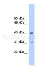ARP40264_P050 - PHOSPHO2