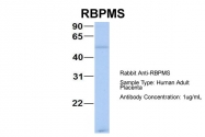 ARP40268_P050 - RBPMS / HERMES