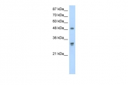 ARP40299_T100 - DDX19B