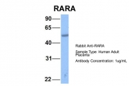 ARP40314_P050 - RAR-alpha / RARA