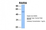 ARP40314_P050 - RAR-alpha / RARA
