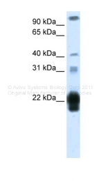 ARP40350_T100 - Placental Lactogen