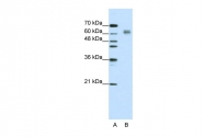 ARP40359_T100 - EIF4B
