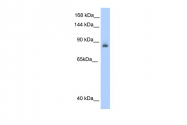 ARP40390_P050 - ACO1 / IREB1