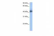 ARP40426_P050 - RBM4 / RBM4A