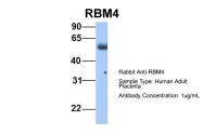 ARP40426_P050 - RBM4 / RBM4A