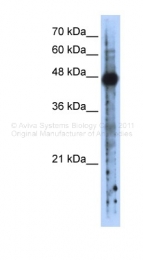 ARP40429_P050 - RBMS2 / SCR3