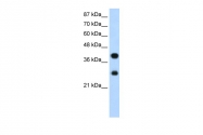 ARP40568_T100 - PCBP2 / hnRNP-E2