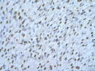 ARP40585_T100 - hnRPD-like protein / HNRPDL